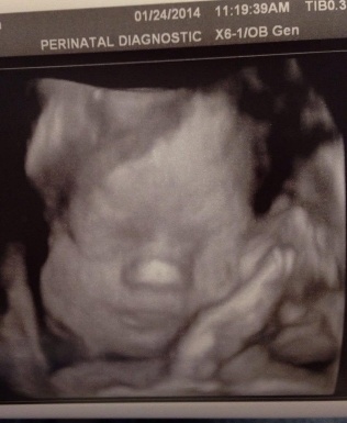 Bradley as a baby